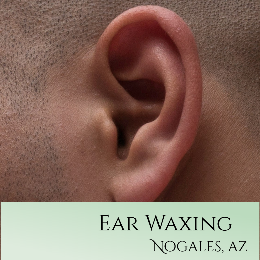 Ear Wax at Nogales, AZ