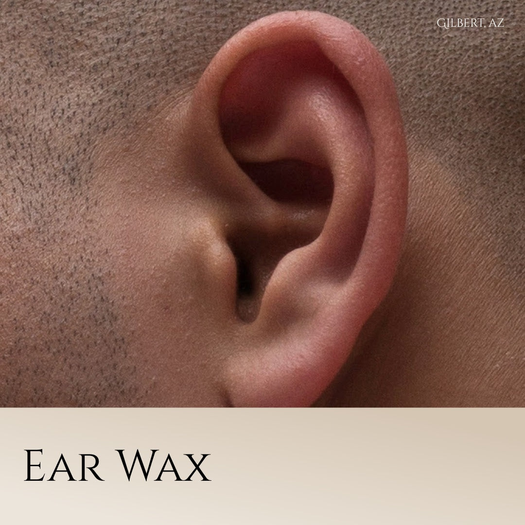 Ear Wax at Gilbert, AZ