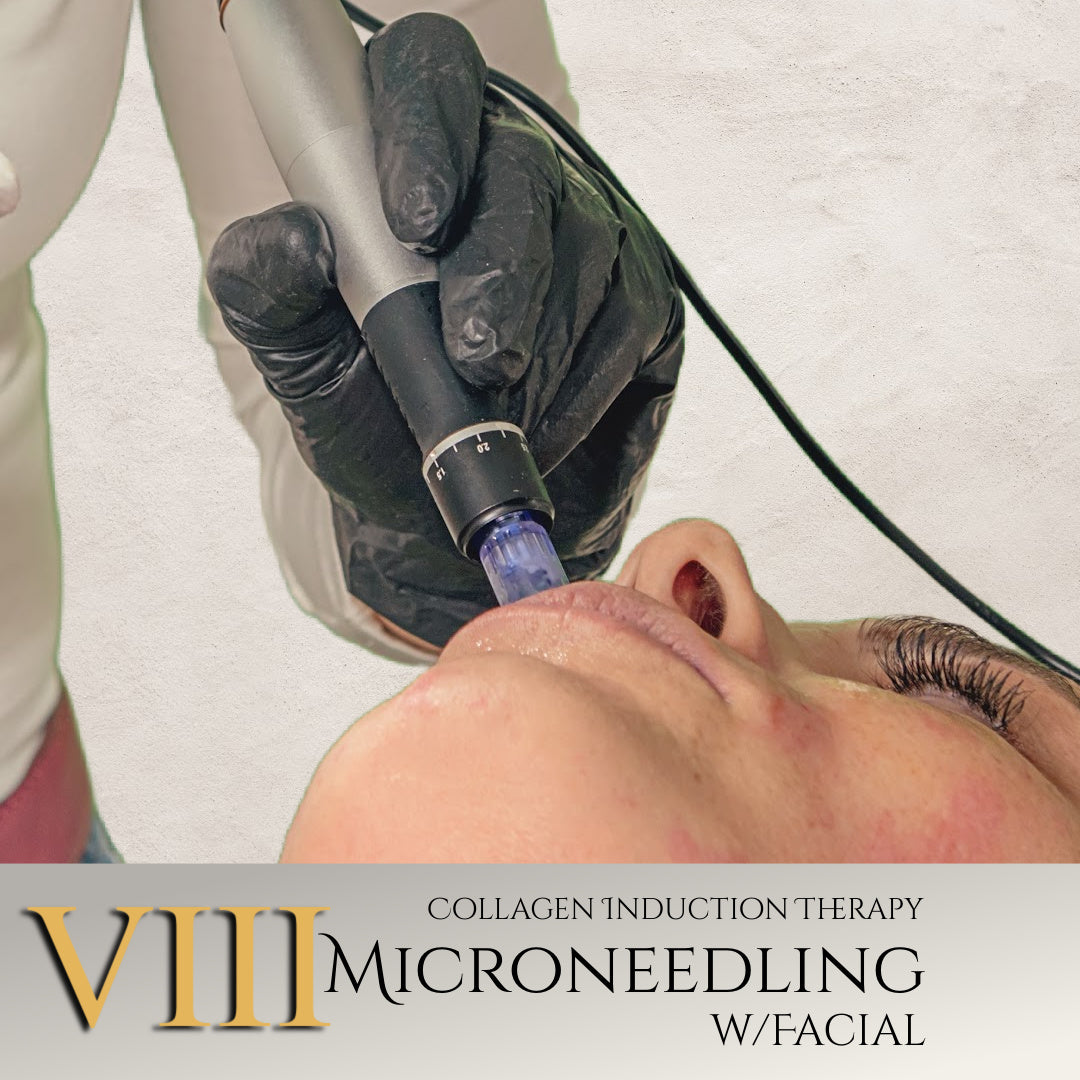 Microneedling (8 sessions, 1 yr. value) at Nogales