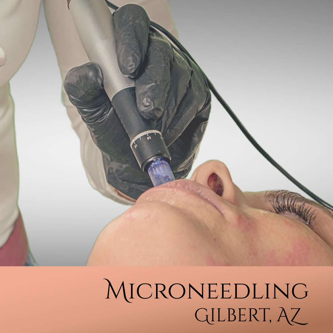 Microneedling Facial at Gilbert, AZ